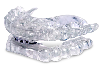clear plastic oral appliance